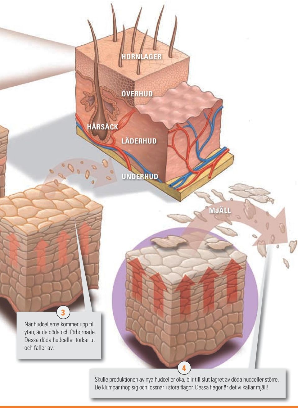 3 4 Skulle produktionen av nya hudceller öka, blir till slut lagret av döda hudceller