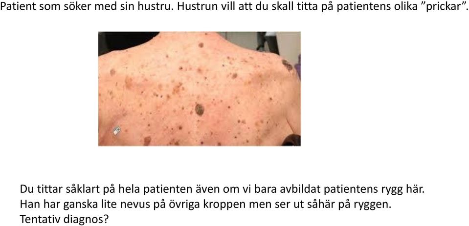 Du tittar såklart på hela patienten även om vi bara avbildat