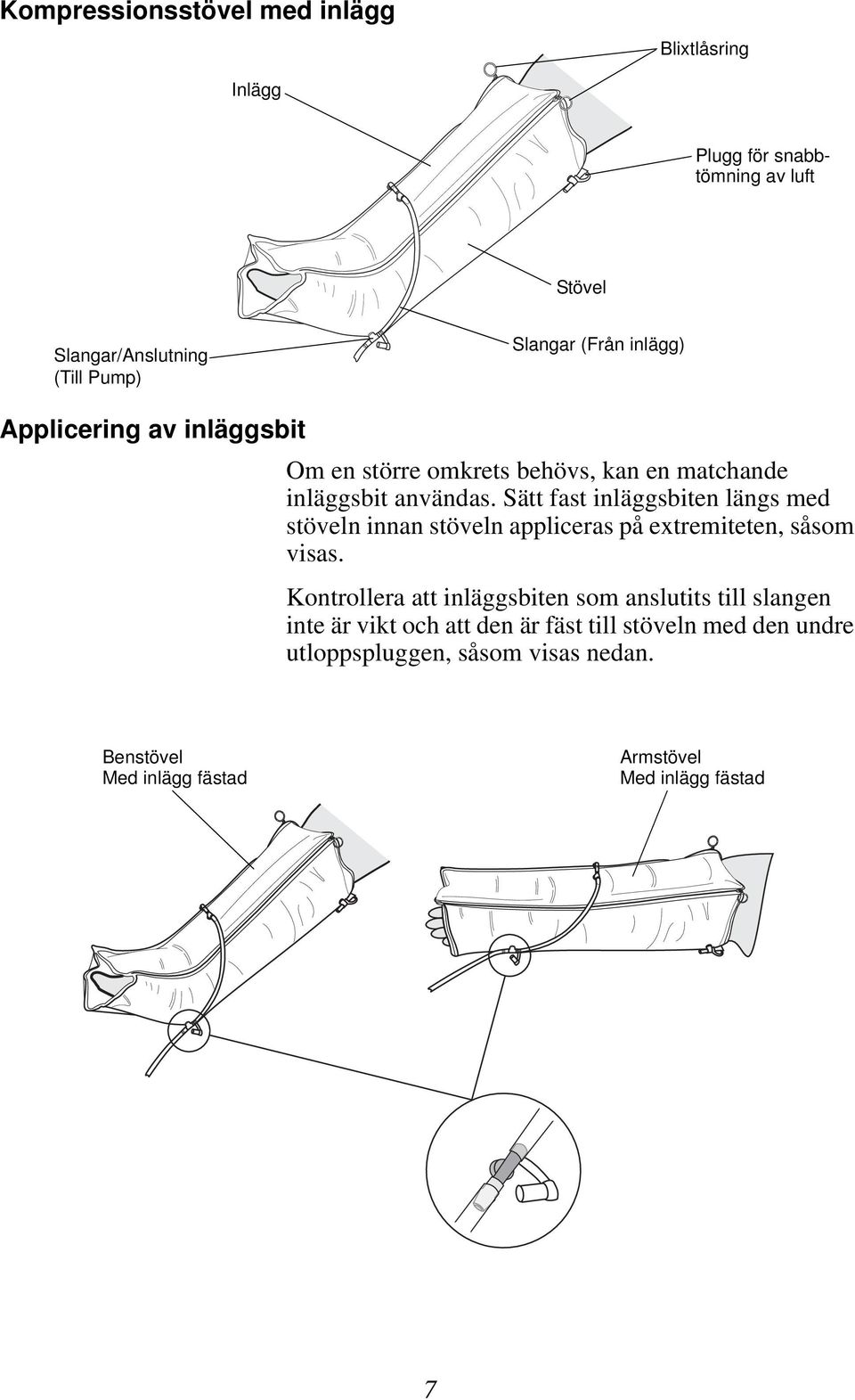 Sätt fast inläggsbiten längs med stöveln innan stöveln appliceras på extremiteten, såsom visas.