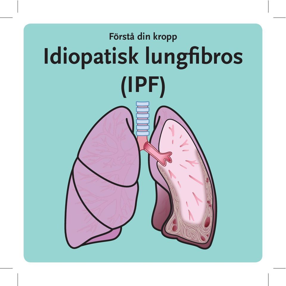 Idiopatisk