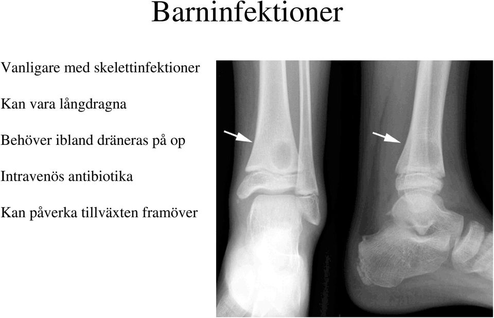 Behöver ibland dräneras på op