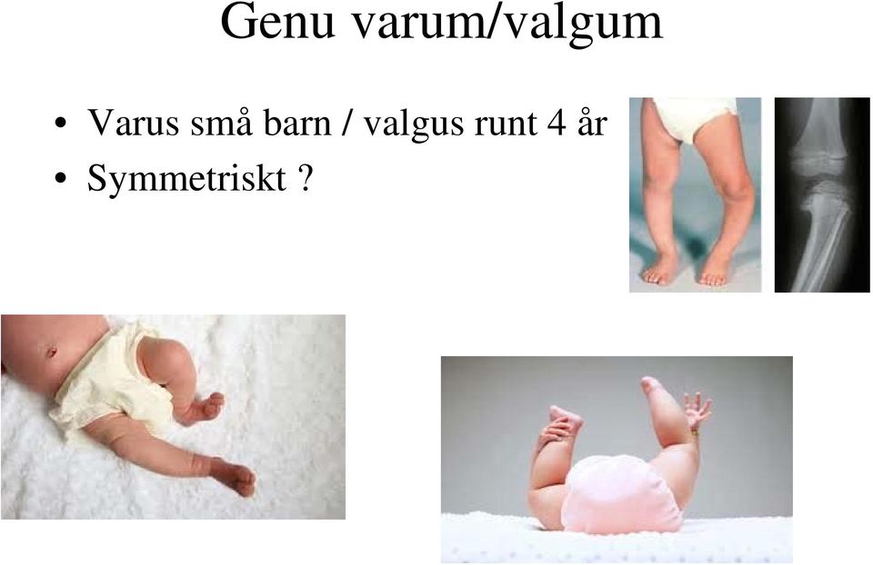 Varus små barn /