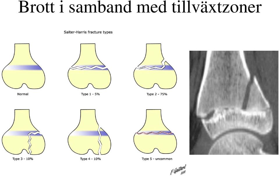 med