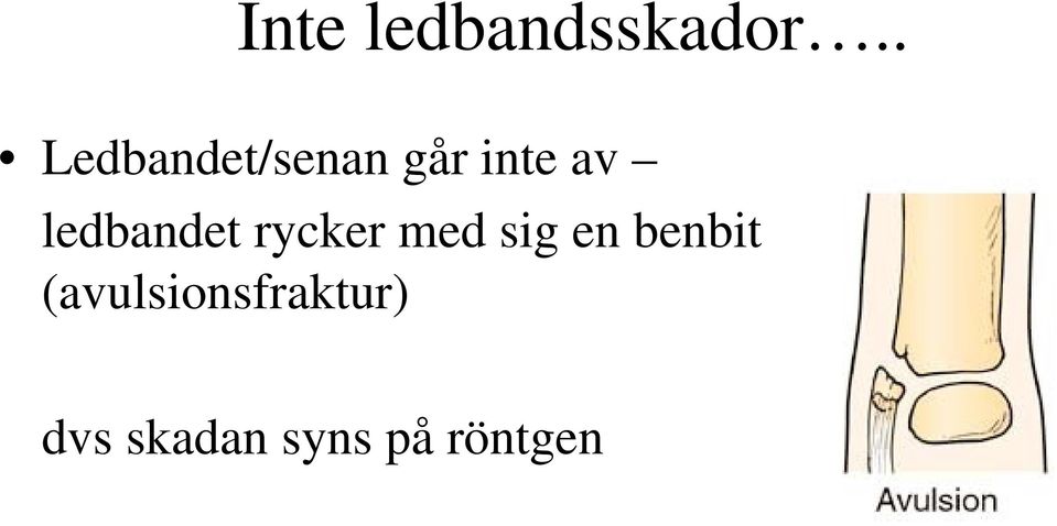 ledbandet rycker med sig en