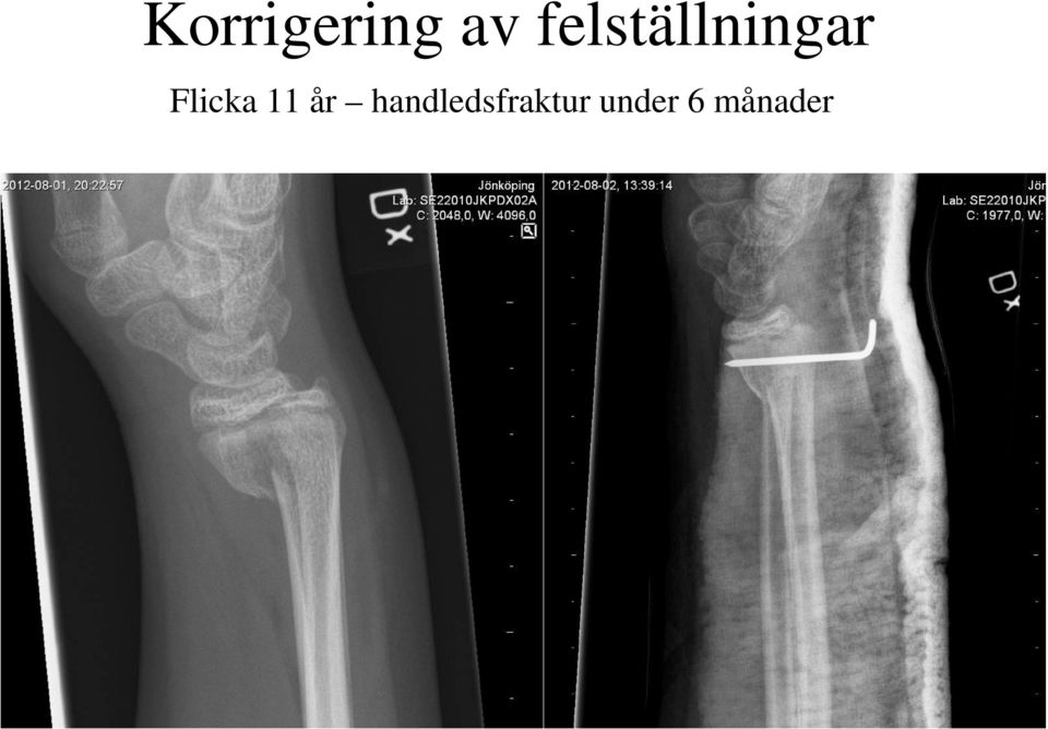 Flicka 11 år