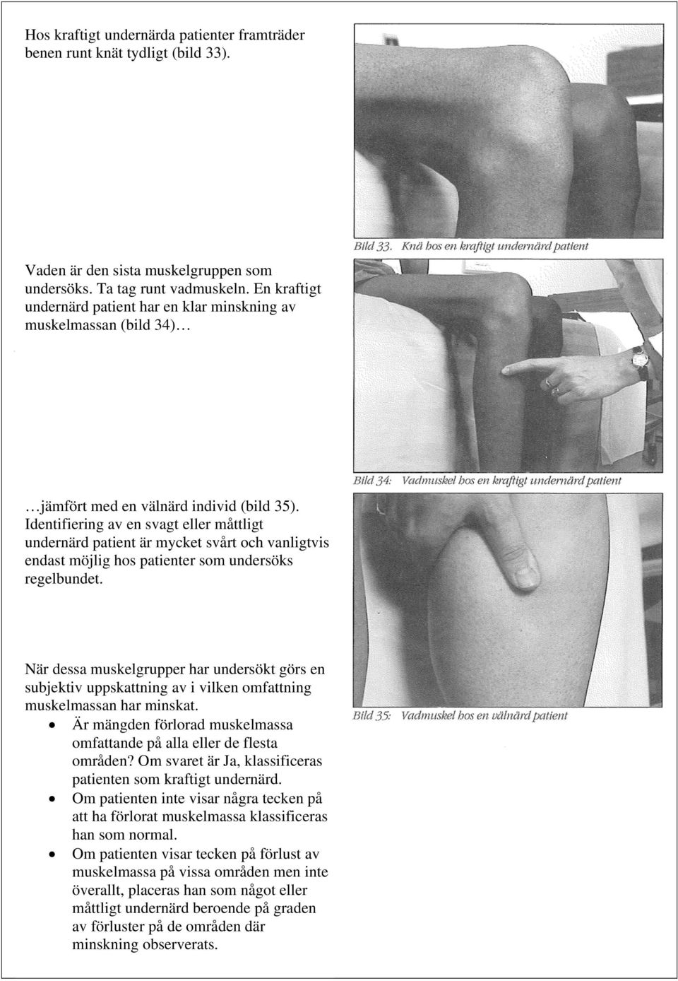 Identifiering av en svagt eller måttligt undernärd patient är mycket svårt och vanligtvis endast möjlig hos patienter som undersöks regelbundet.