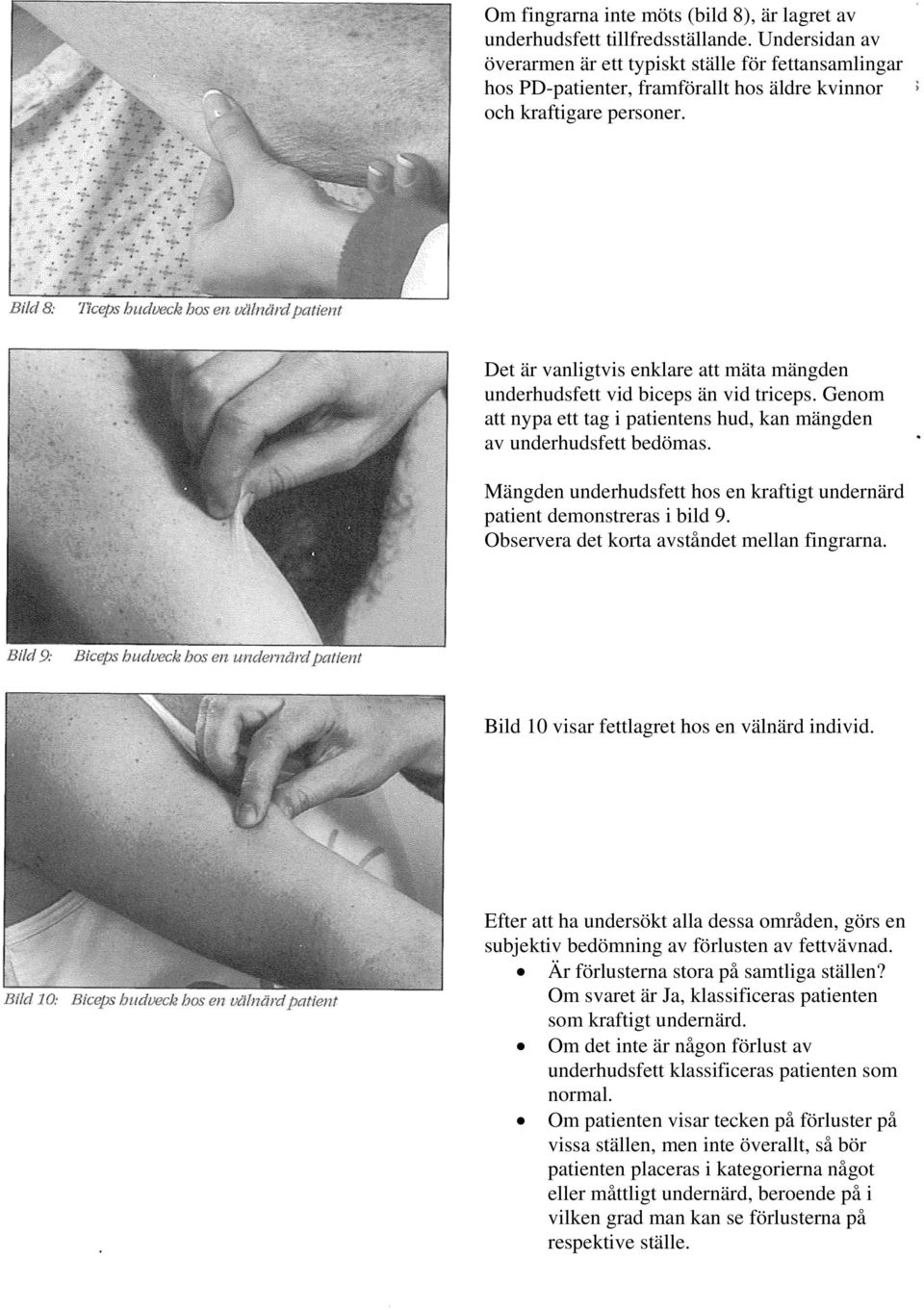 Det är vanligtvis enklare att mäta mängden underhudsfett vid biceps än vid triceps. Genom att nypa ett tag i patientens hud, kan mängden av underhudsfett bedömas.