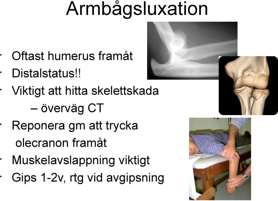 ! Viktigt att hitta skelettskada överväg CT