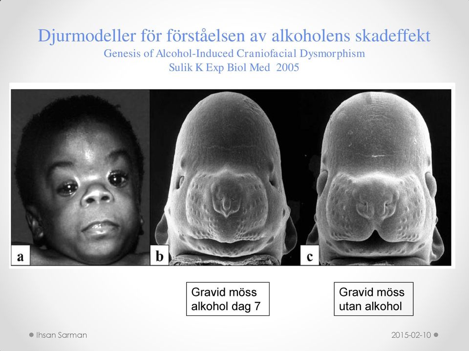 Craniofacial Dysmorphism Sulik K Exp Biol Med