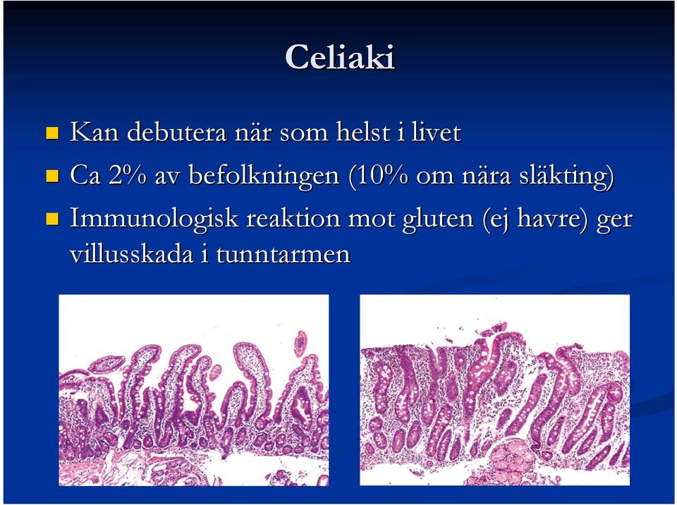 n släkting) Immunologisk reaktion mot