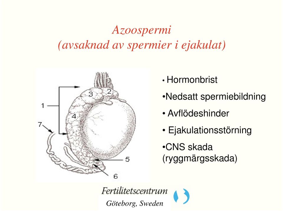 spermiebildning Avflödeshinder