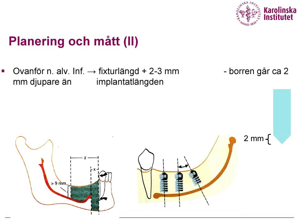 fixturlängd + 2-3 mm - borren