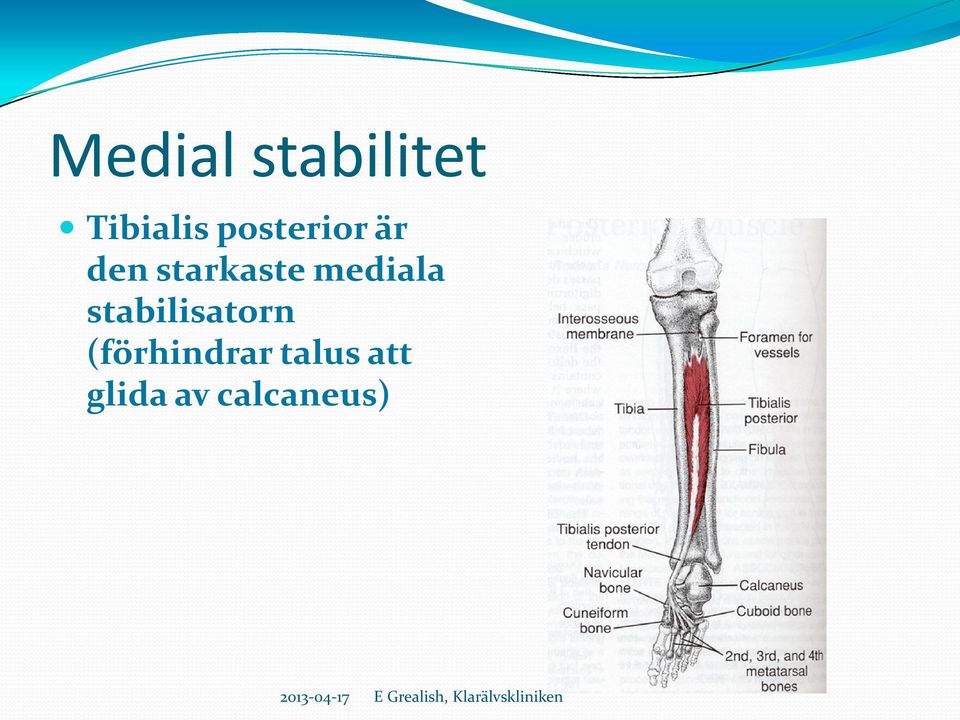 mediala stabilisatorn