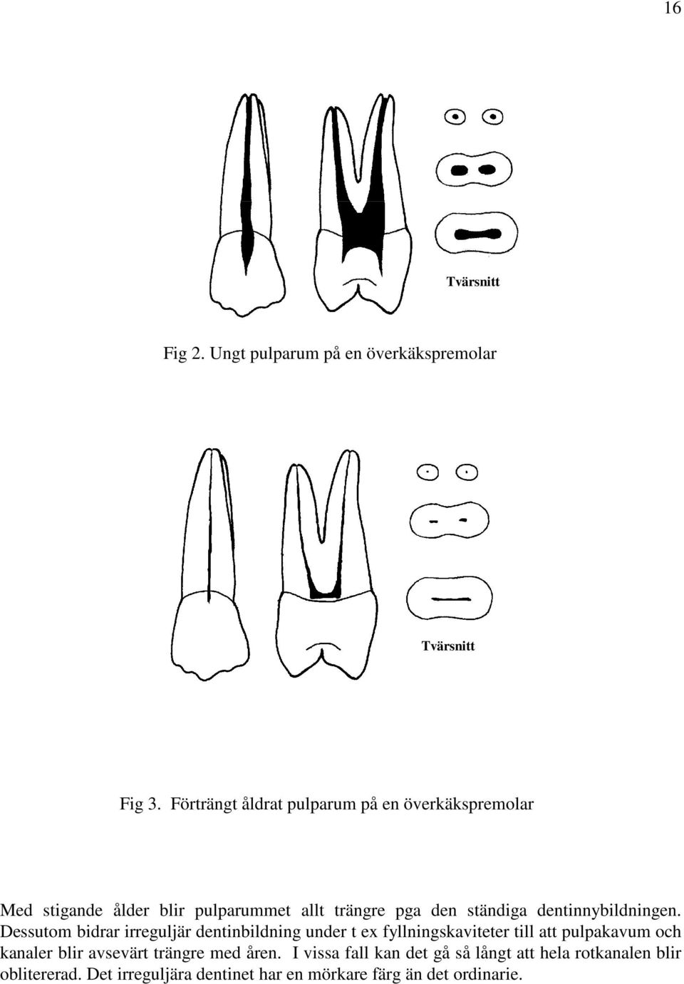 dentinnybildningen.