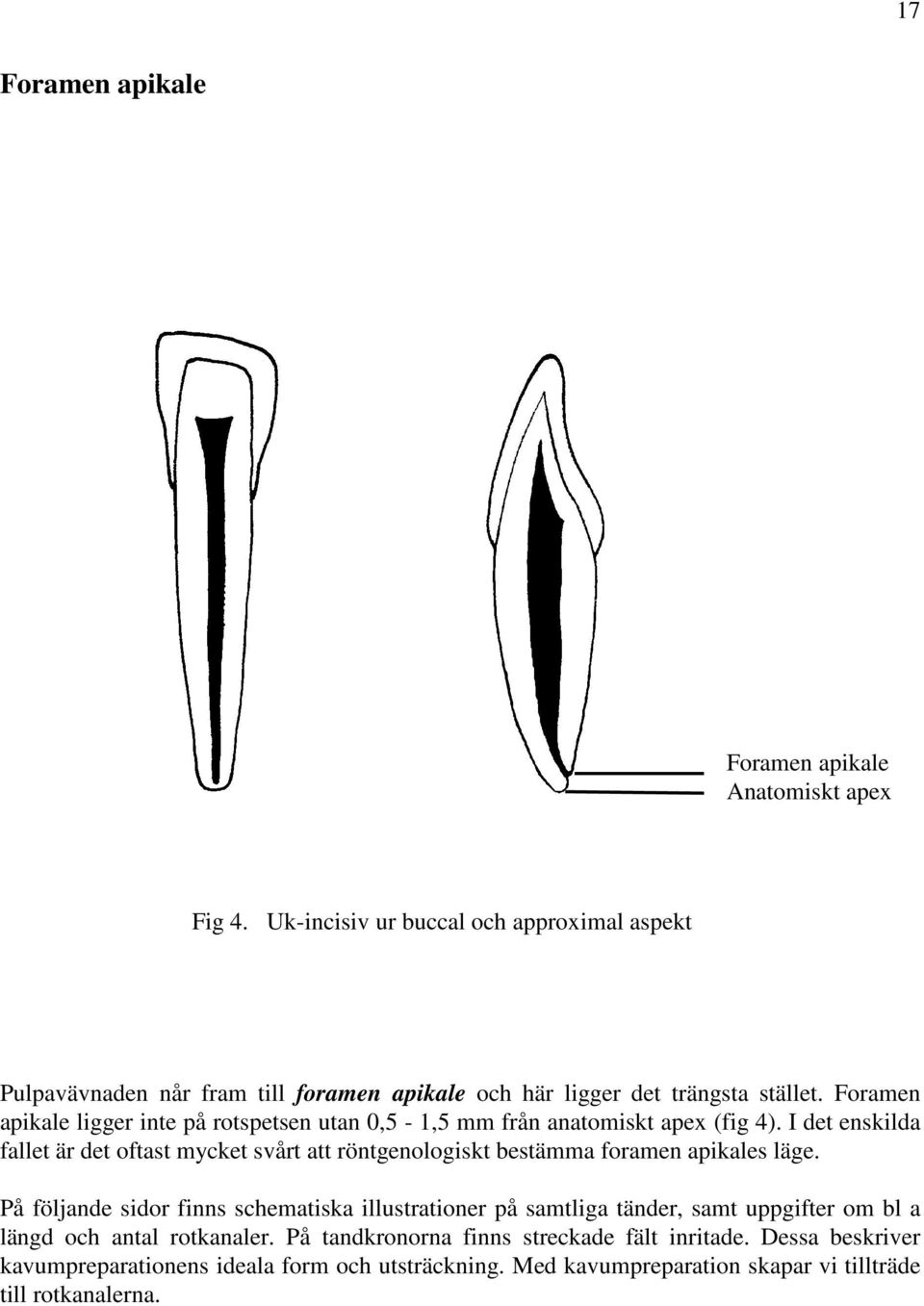 Foramen apikale ligger inte på rotspetsen utan 0,5-1,5 mm från anatomiskt apex (fig 4).