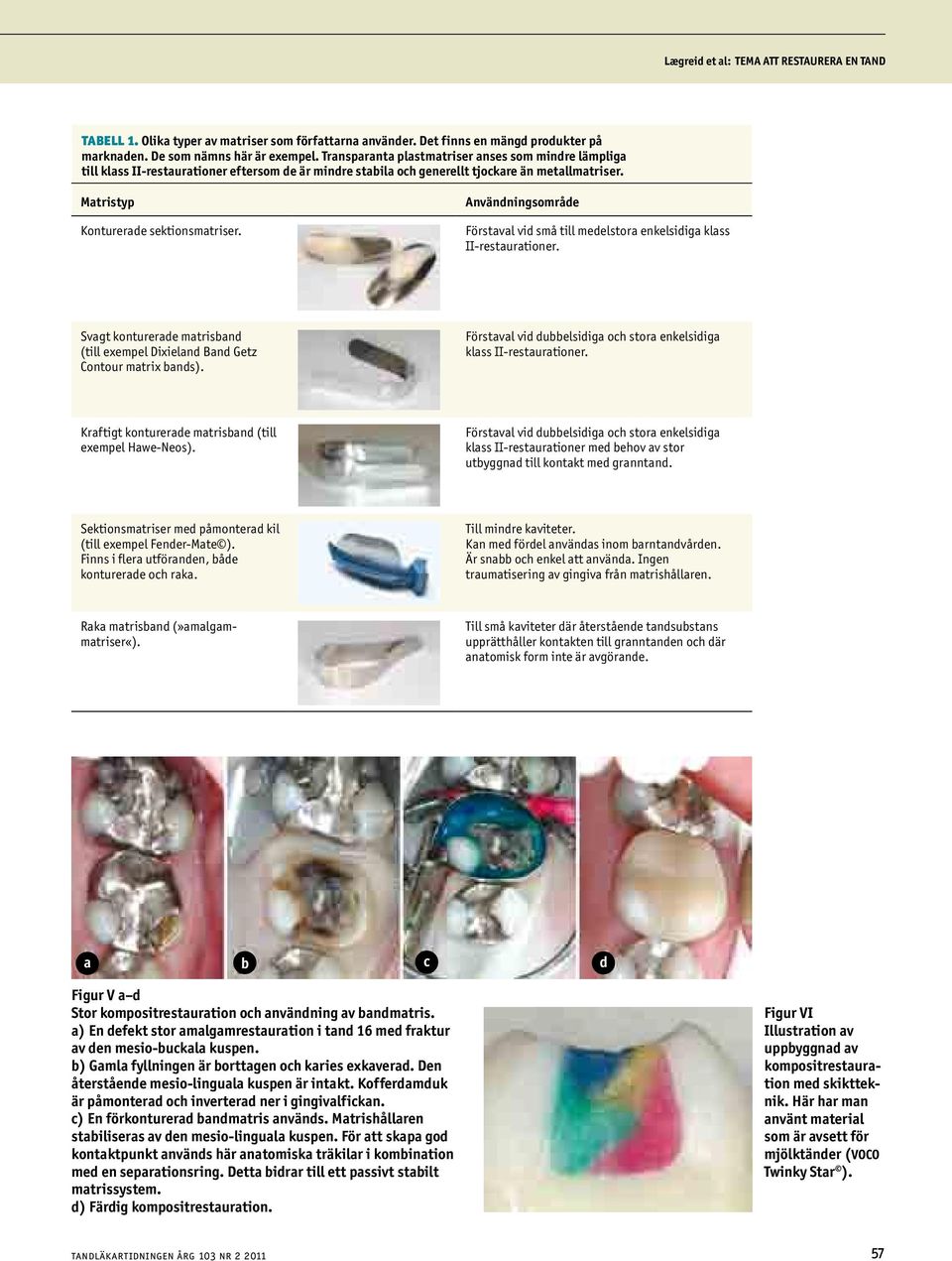 Användningsområde Förstaval vid små till medelstora enkelsidiga klass II-restaurationer. Svagt konturerade matrisband (till exempel Dixieland Band Getz Contour matrix bands).