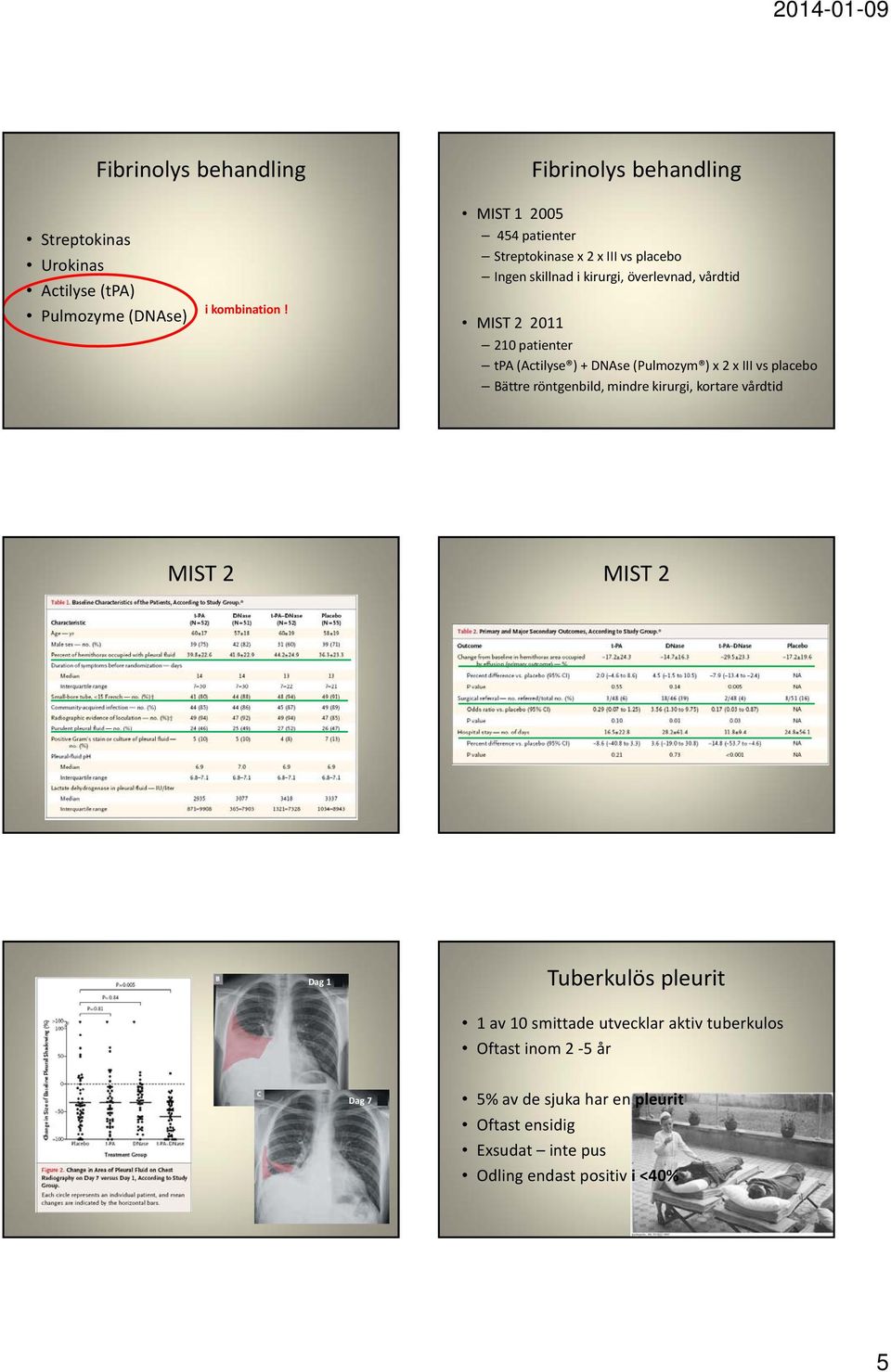 (Actilyse ) + DNAse (Pulmozym ) x 2 x III vs placebo Bättre röntgenbild, mindre kirurgi, kortare vårdtid 25 26 MIST 2 MIST 2 27 28 Dag 1