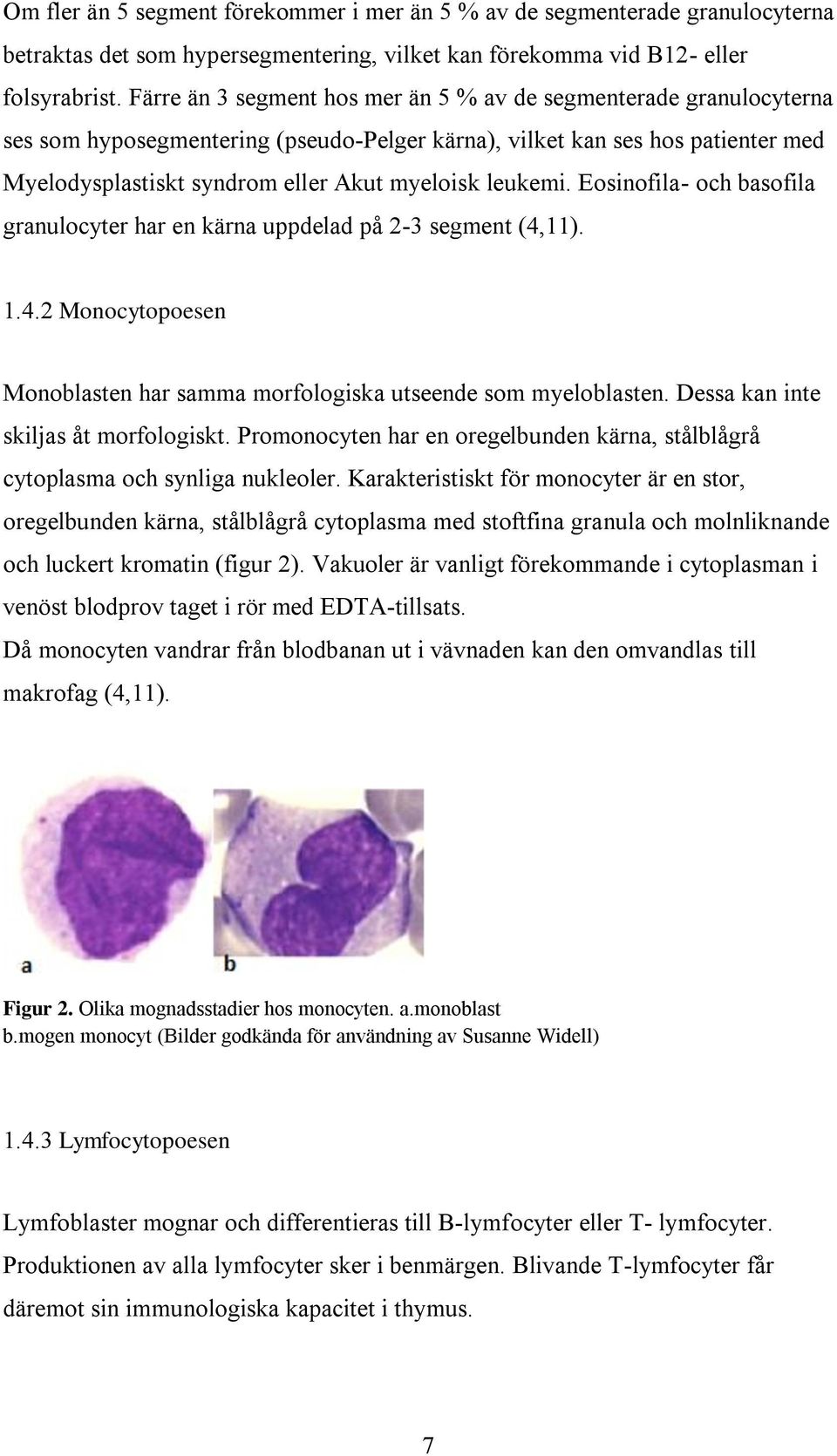 leukemi. Eosinofila- och basofila granulocyter har en kärna uppdelad på 2-3 segment (4,11). 1.4.2 Monocytopoesen Monoblasten har samma morfologiska utseende som myeloblasten.