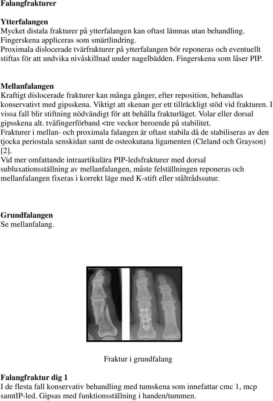 Mellanfalangen Kraftigt dislocerade frakturer kan många gånger, efter reposition, behandlas konservativt med gipsskena. Viktigt att skenan ger ett tillräckligt stöd vid frakturen.