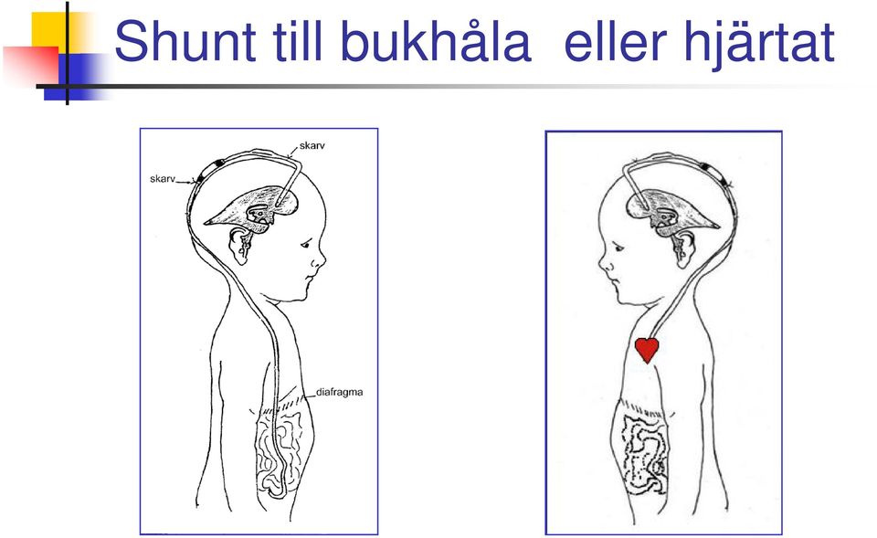 bukhåla