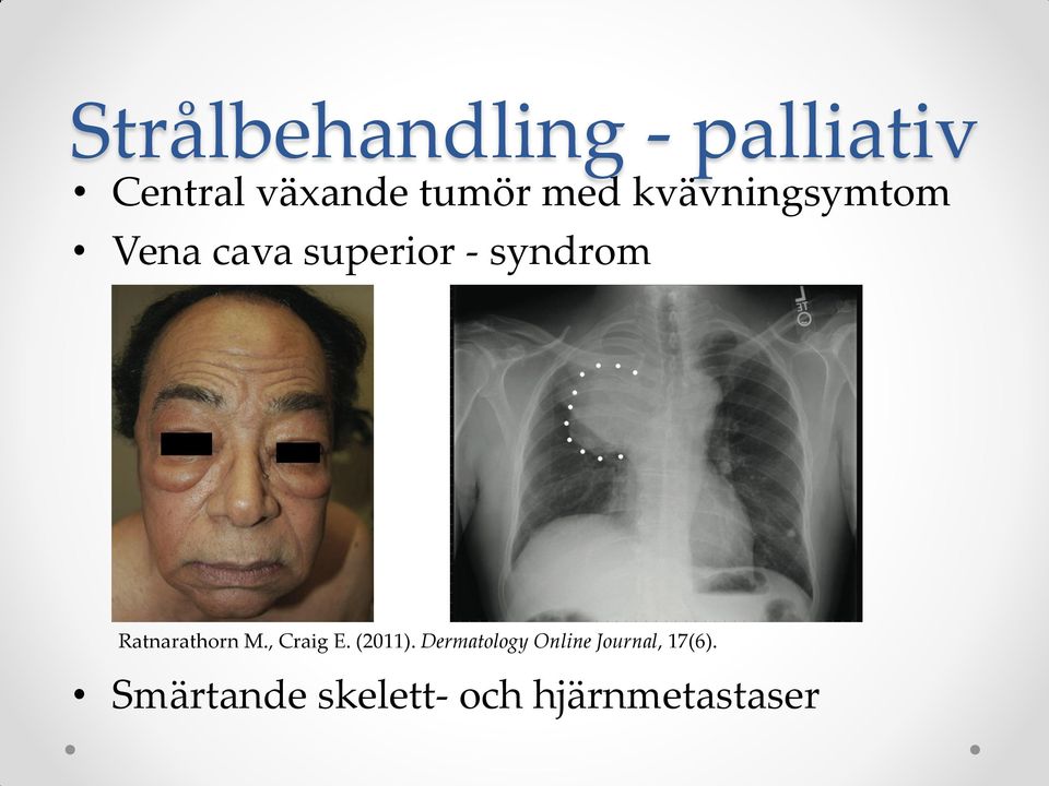 Ratnarathorn M., Craig E. (2011).