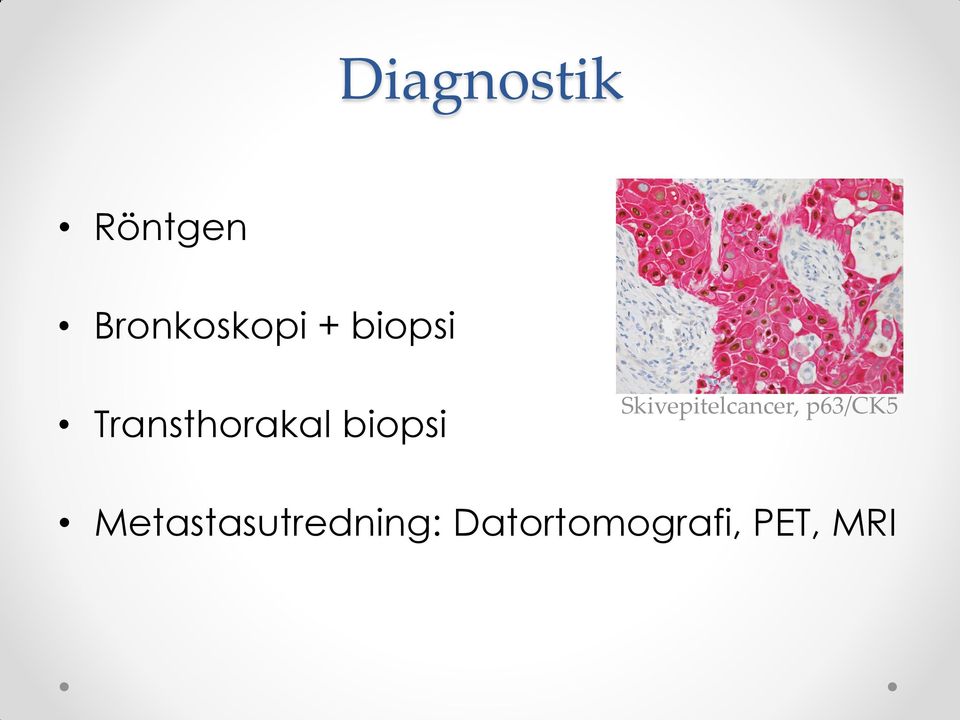 Skivepitelcancer, p63/ck5