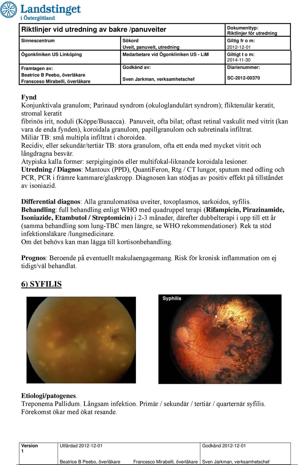 Recidiv, eller sekundär/tertiär TB: stora granulom, ofta ett enda med mycket vitrit och långdragna besvär. Atypiska kalla former: serpiginginös eller multifokal-liknande koroidala lesioner.