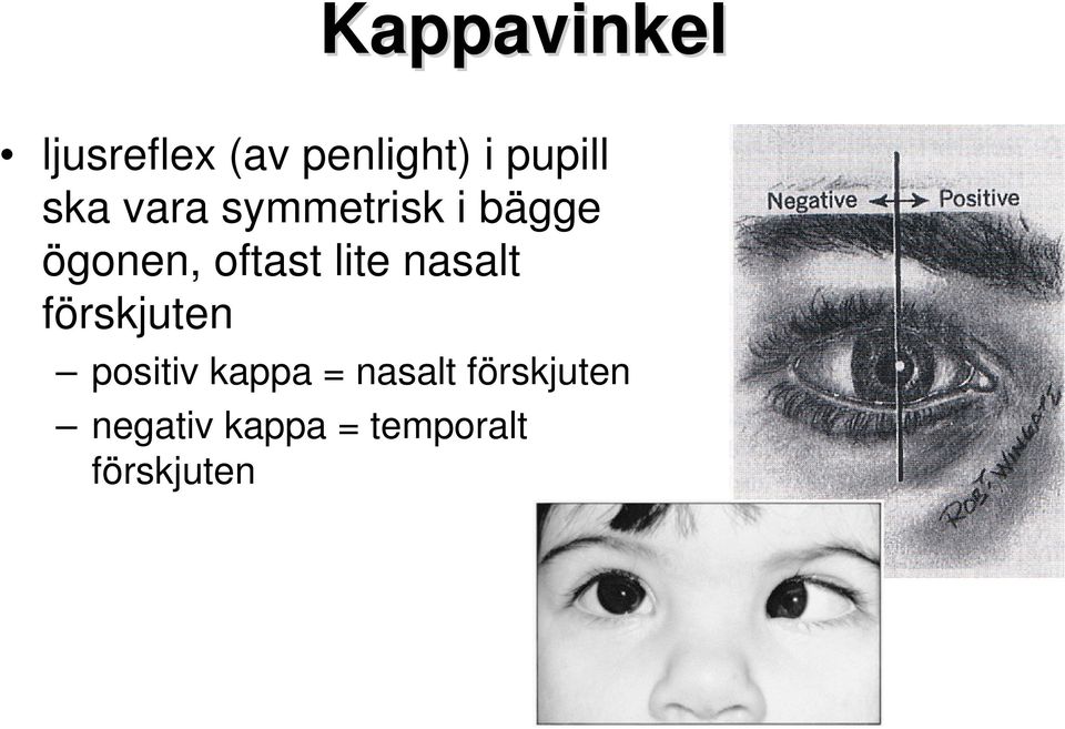 lite nasalt förskjuten positiv kappa = nasalt