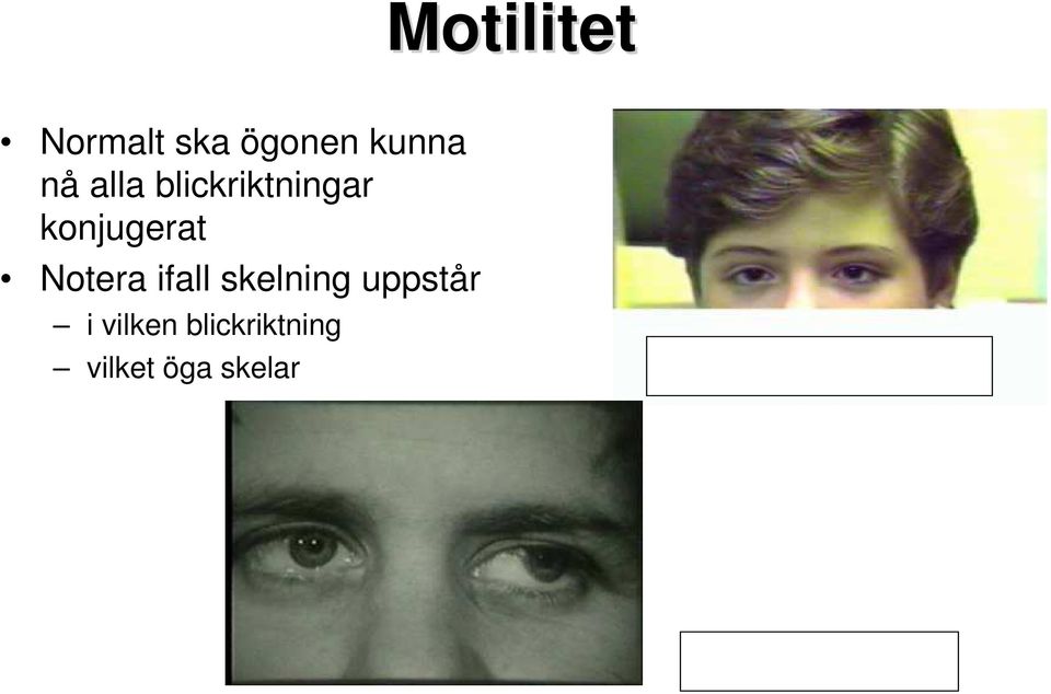 skelning uppstår i vilken blickriktning