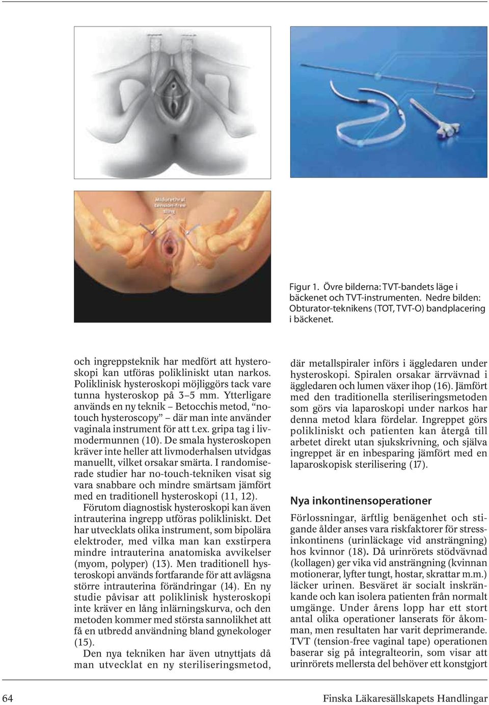 Ytterligare används en ny teknik Betocchis metod, notouch hysteroscopy där man inte använder vaginala instrument för att t.ex. gripa tag i livmodermunnen (10).