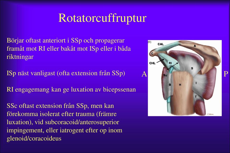 av bicepssenan SSc oftast extension från SSp, men kan förekomma isolerat efter trauma (främre