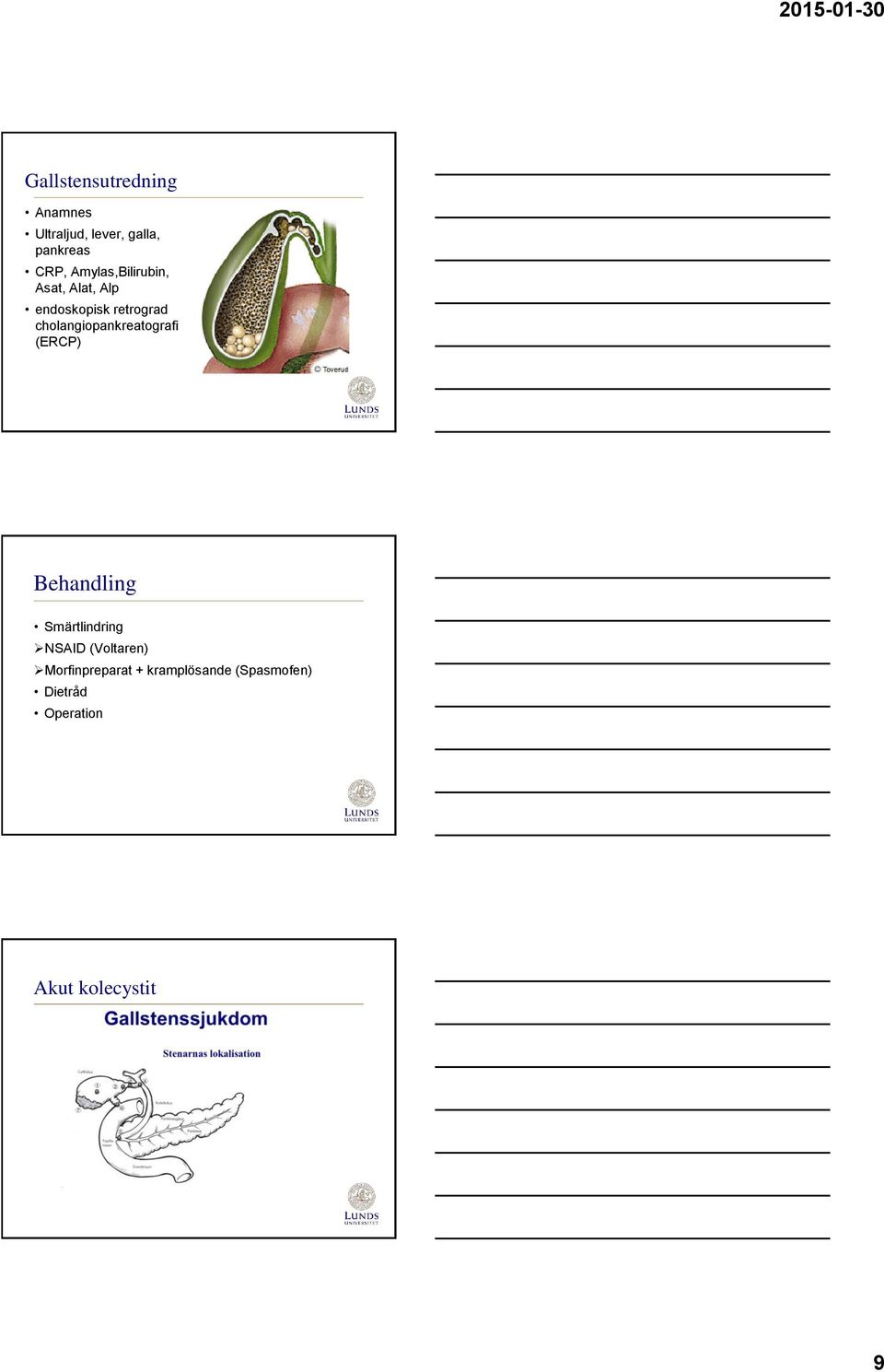 cholangiopankreatografi (ERCP) Behandling Smärtlindring NSAID