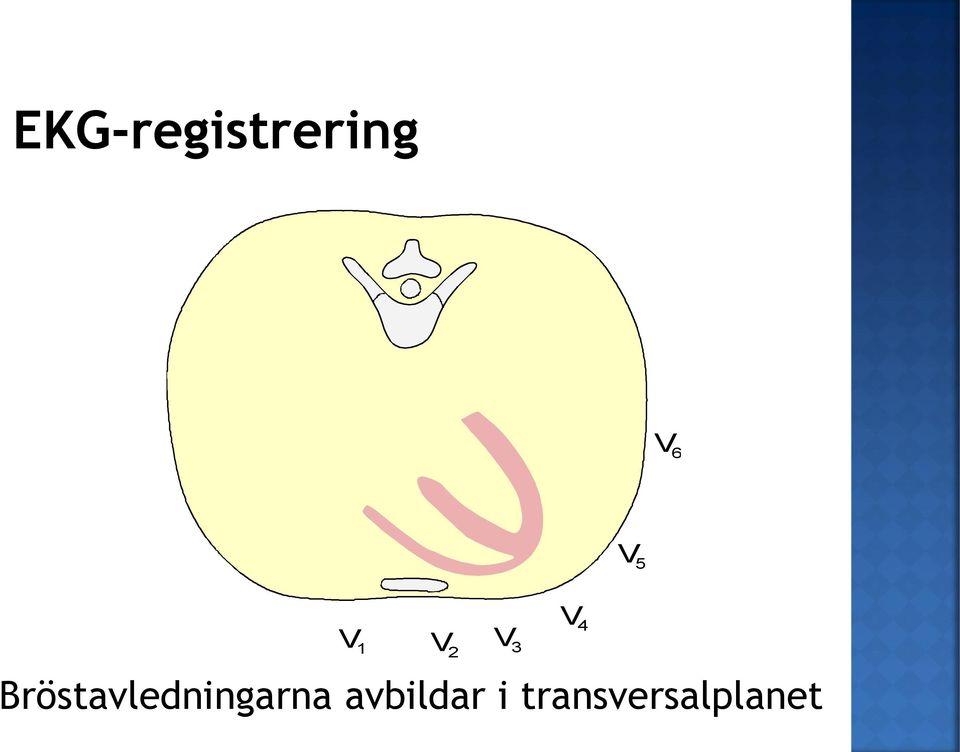 Bröstavledningarna