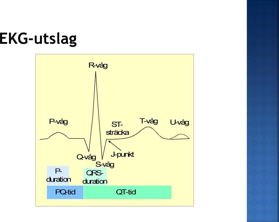 duration PQ-tid Q-våg