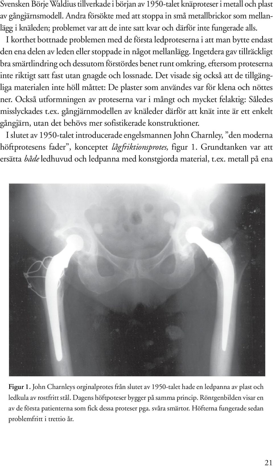 I korthet bottnade problemen med de första ledproteserna i att man bytte endast den ena delen av leden eller stoppade in något mellanlägg.