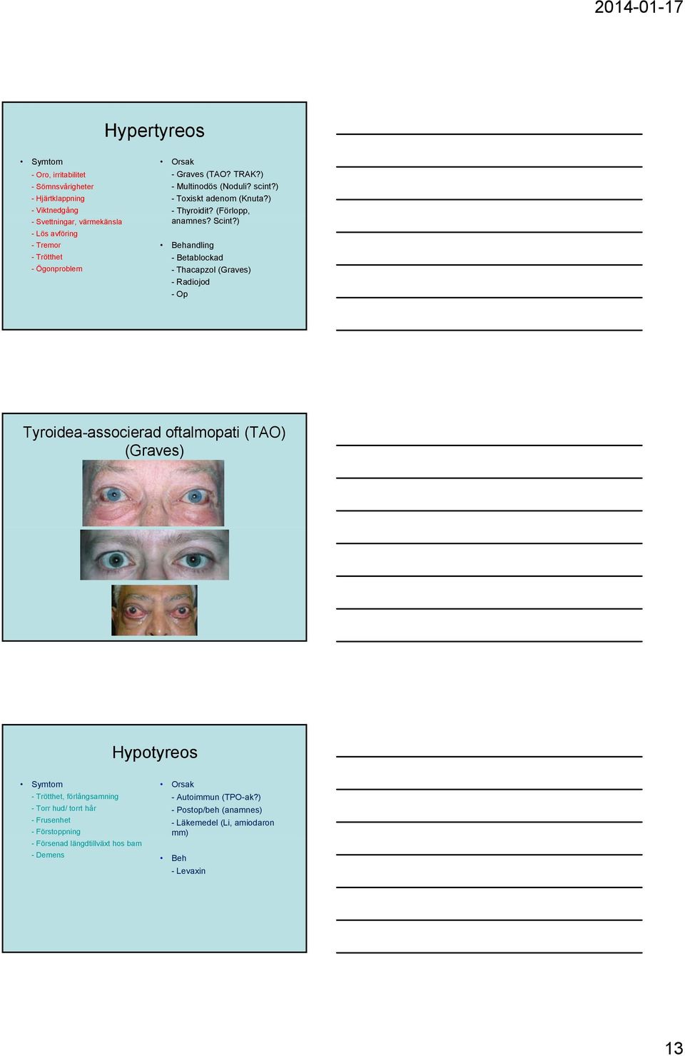 ) Behandling - Betablockad - Thacapzol (Graves) - Radiojod -Op Tyroidea-associerad oftalmopati (TAO) (Graves) Hypotyreos Symtom - Trötthet, förlångsamning -