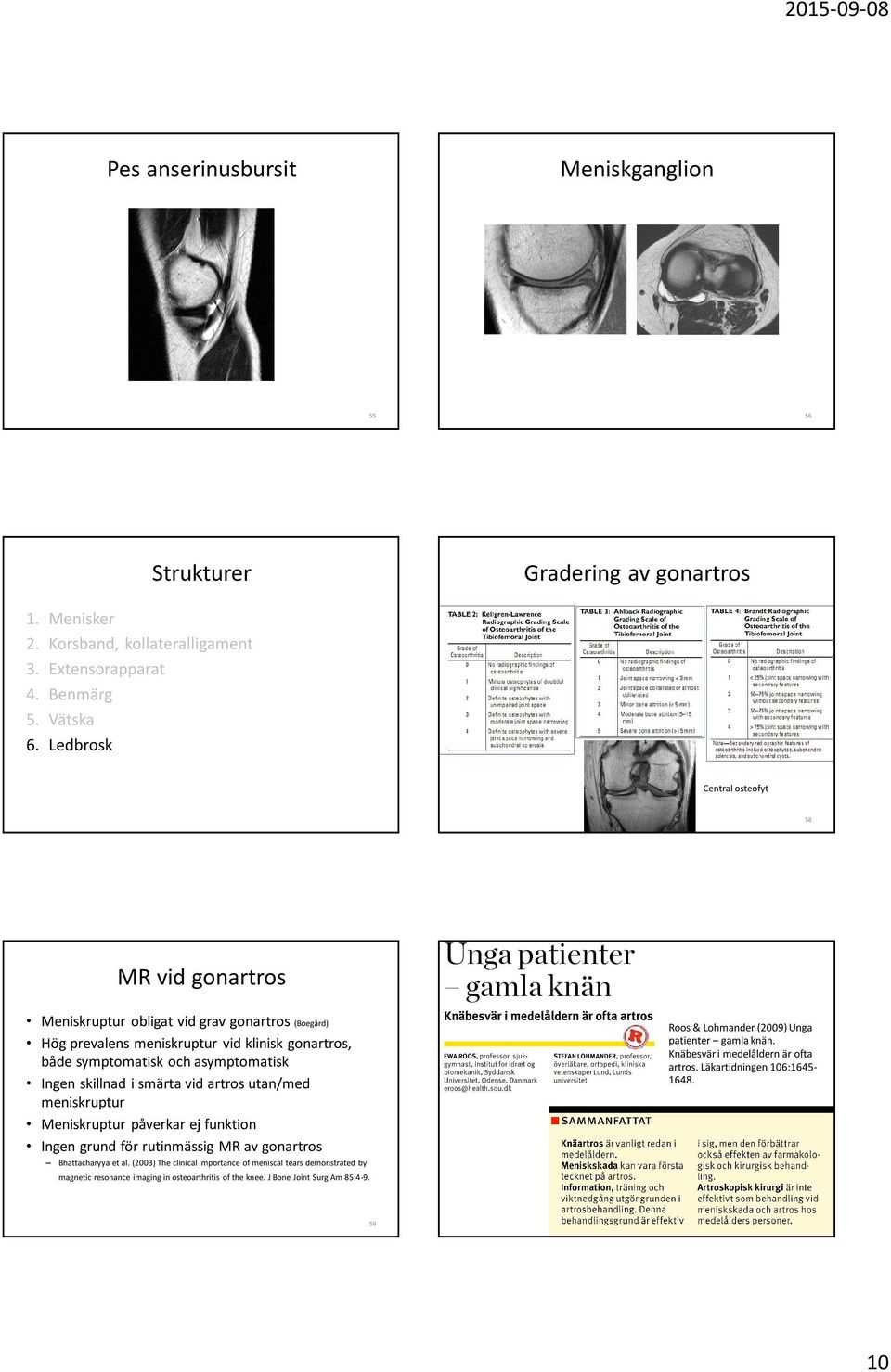 skillnad i smärta vid artros utan/med meniskruptur Meniskruptur påverkar ej funktion Ingen grund för rutinmässig MR av gonartros Bhattacharyya et al.