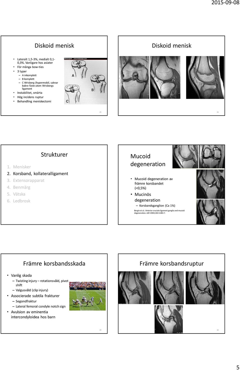 meniskectomi 25 26 1. Menisker 2. Korsband, kollateralligament 3. Extensorapparat 4. Benmärg 5. Vätska 6.