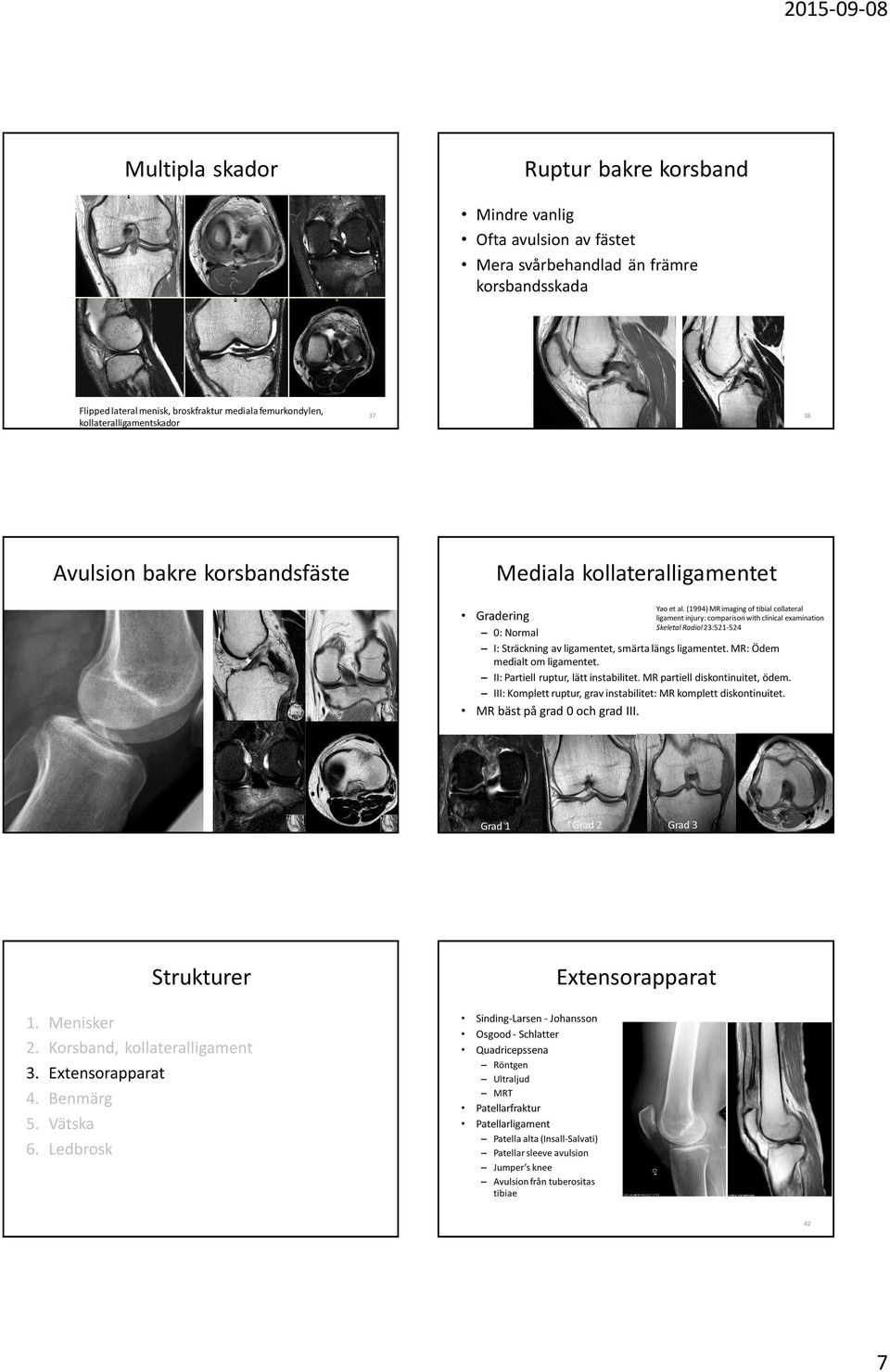 (1994) MR imaging of tibial collateral ligament injury: comparison with clinical examination Skeletal Radiol 23:521-524 I: Sträckning av ligamentet, smärta längs ligamentet.