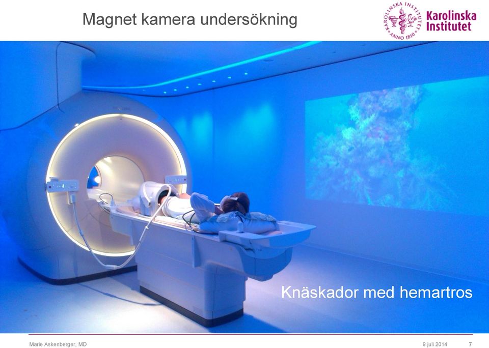 Knäskador med