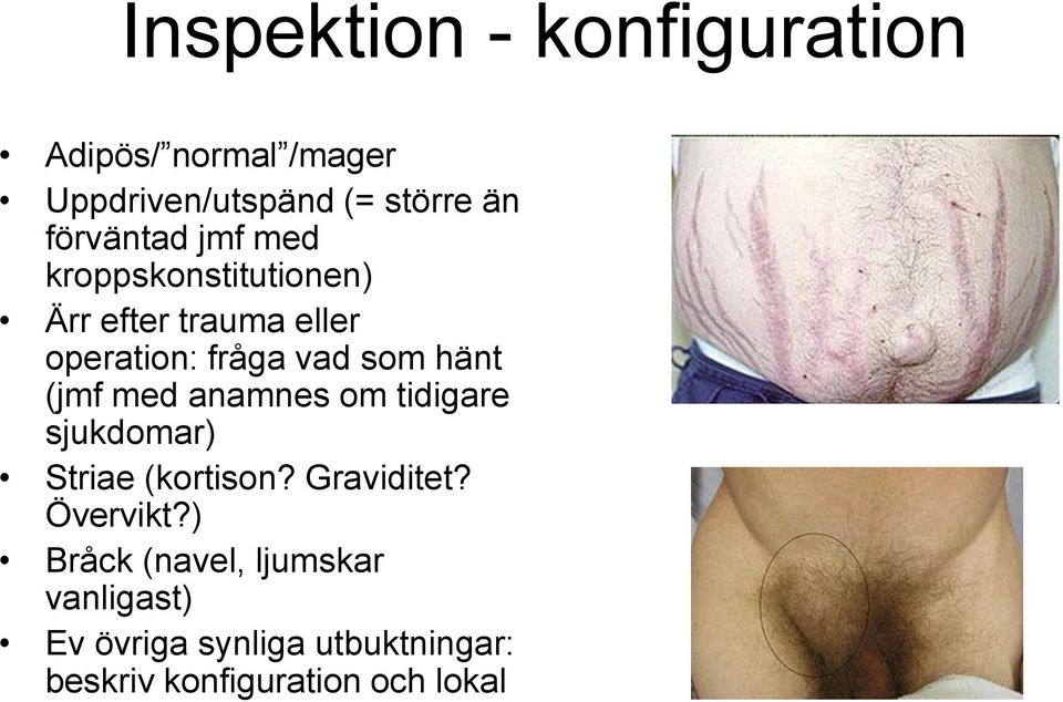 hänt (jmf med anamnes om tidigare sjukdomar) Striae (kortison? Graviditet? Övervikt?