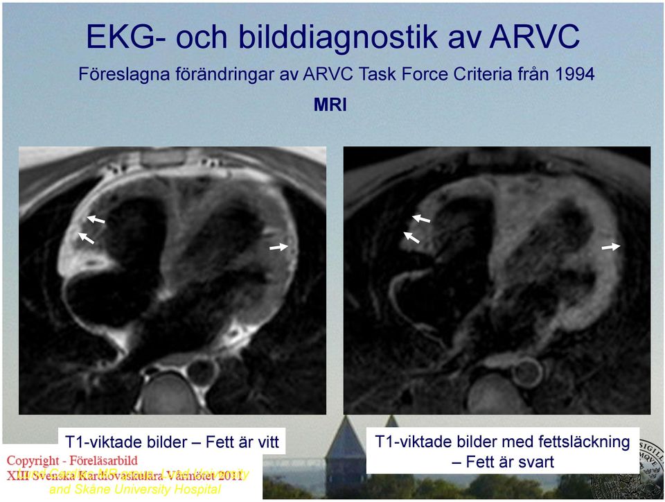 T1-viktade bilder Fett är vitt