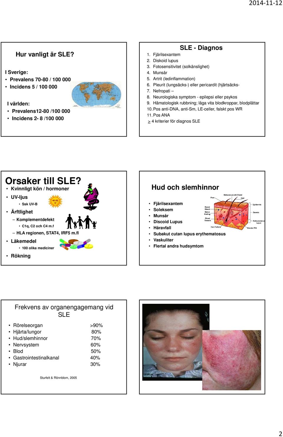 Hämatologisk rubbning; låga vita blodkroppar, blodplättar 10.Pos anti-dna, anti-sm, LE-celler, falskt pos WR 11.Pos ANA > 4 kriterier för diagnos SLE Orsaker till SLE?