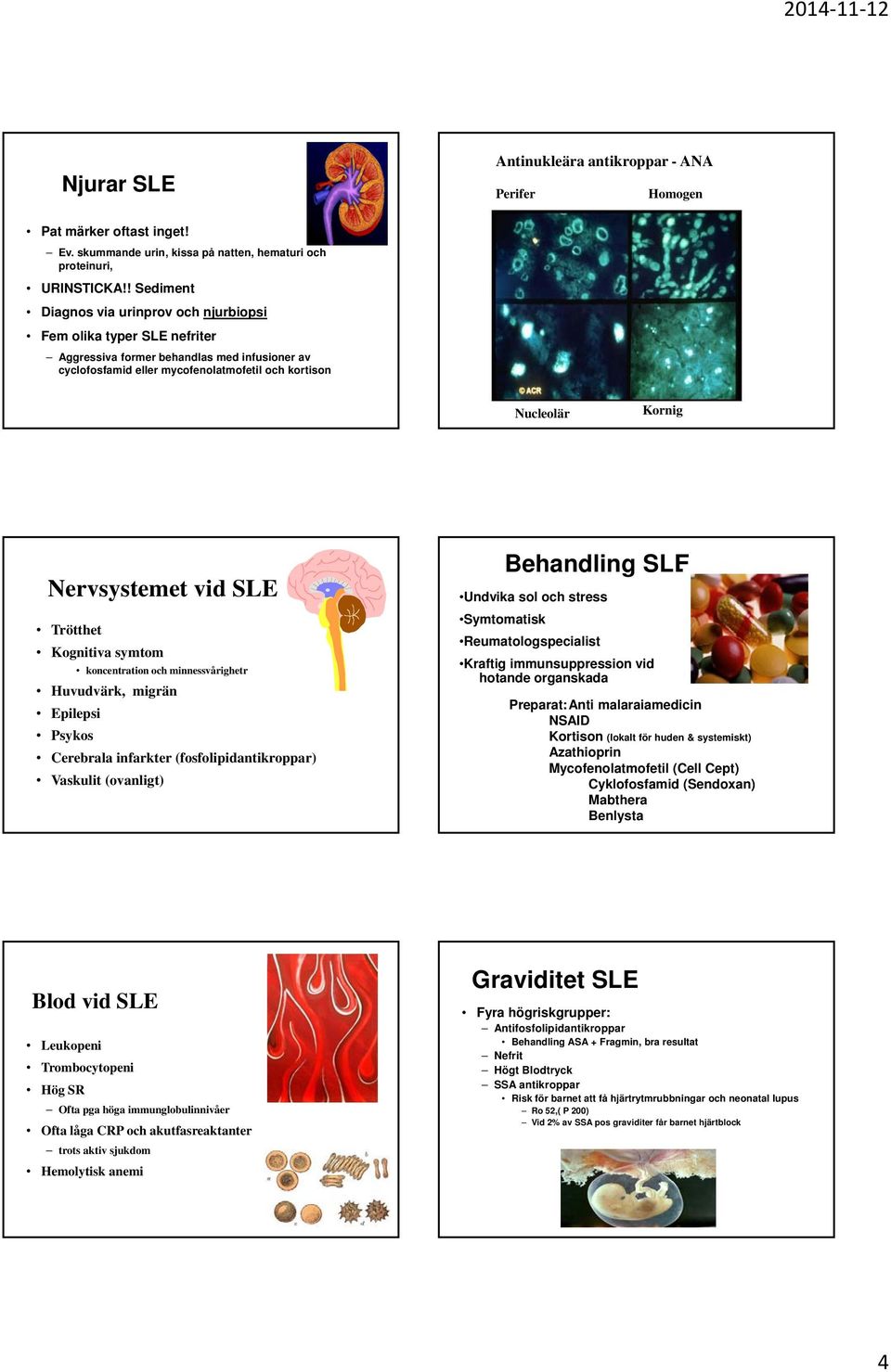 Nervsystemet vid SLE Trötthet Kognitiva symtom koncentration och minnessvårighetr Huvudvärk, migrän Epilepsi Psykos Cerebrala infarkter (fosfolipidantikroppar) Vaskulit (ovanligt) Behandling SLE