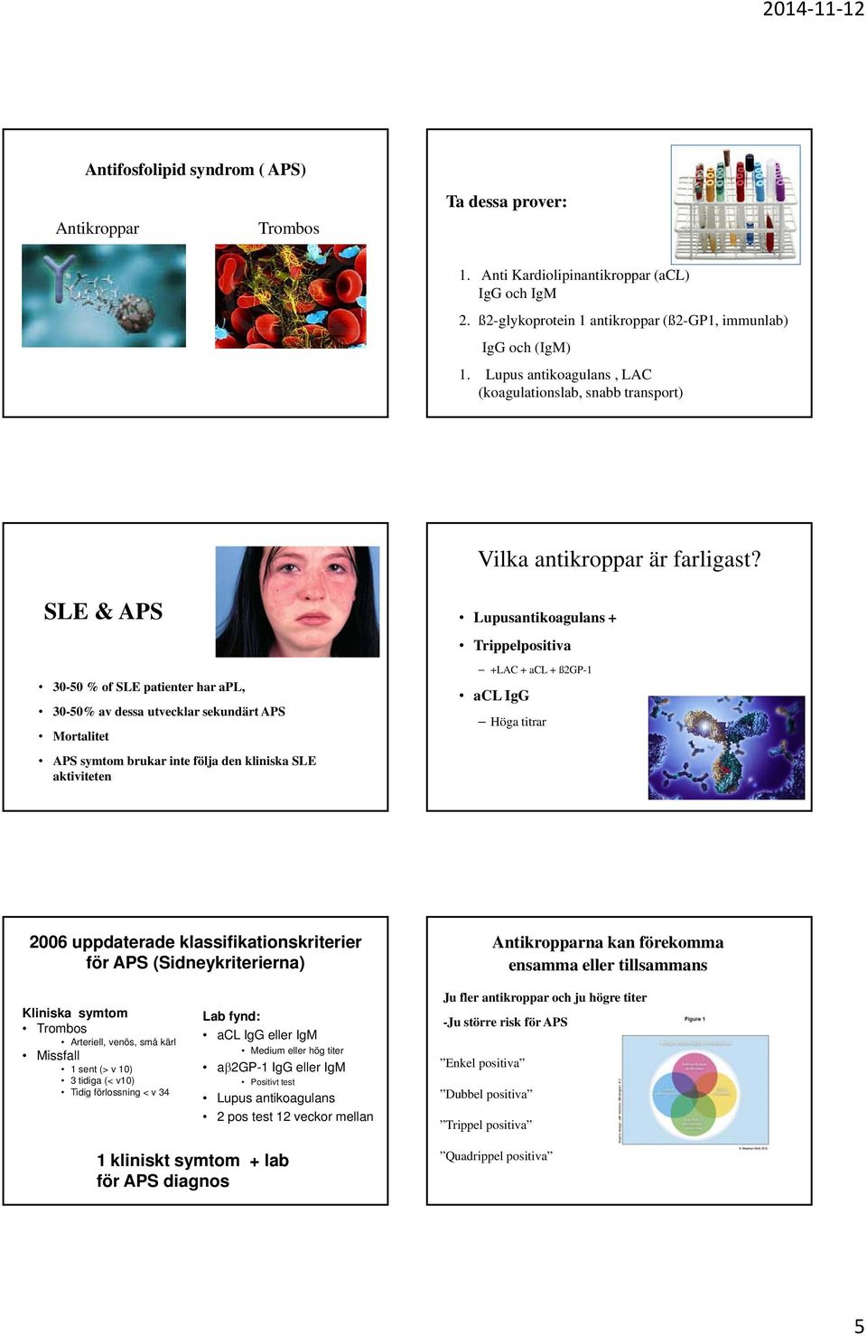 SLE & APS 30-50 % of SLE patienter har apl, 30-50% av dessa utvecklar sekundärt APS Mortalitet APS symtom brukar inte följa den kliniska SLE aktiviteten Lupusantikoagulans + Trippelpositiva +LAC +