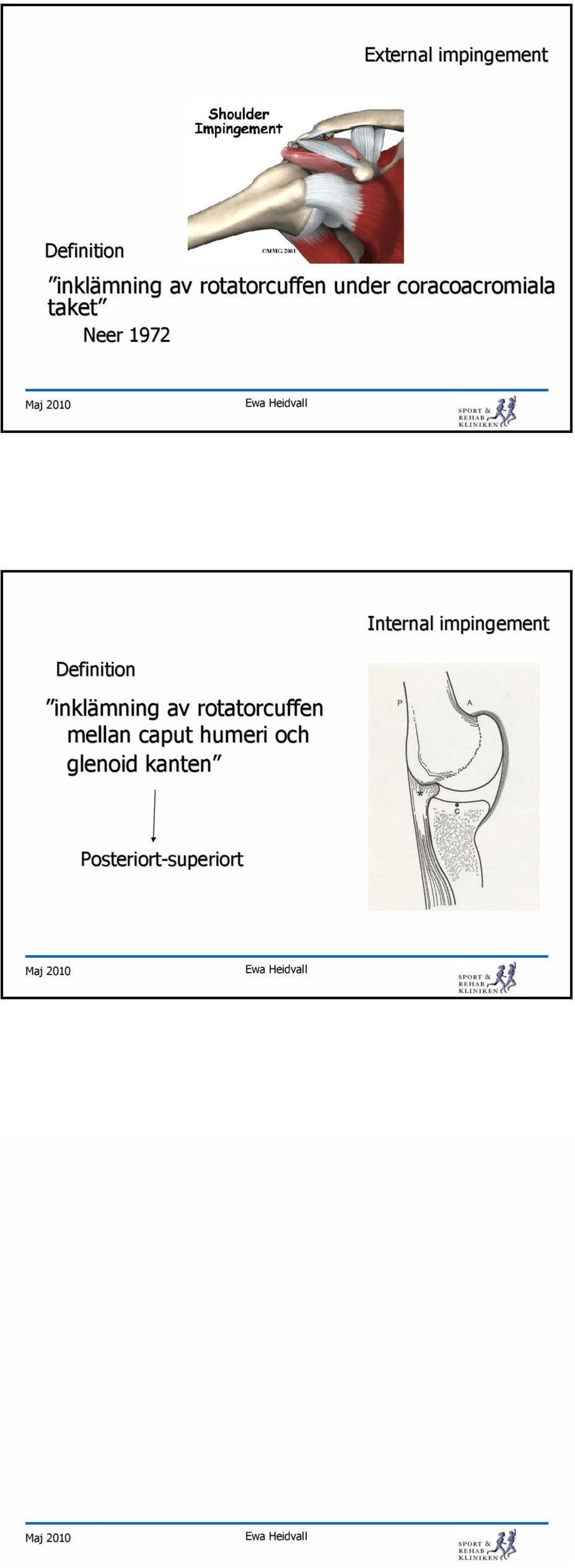 och glenoid kanten Posteriort-superiort superiort symtom External Subacromial Internal