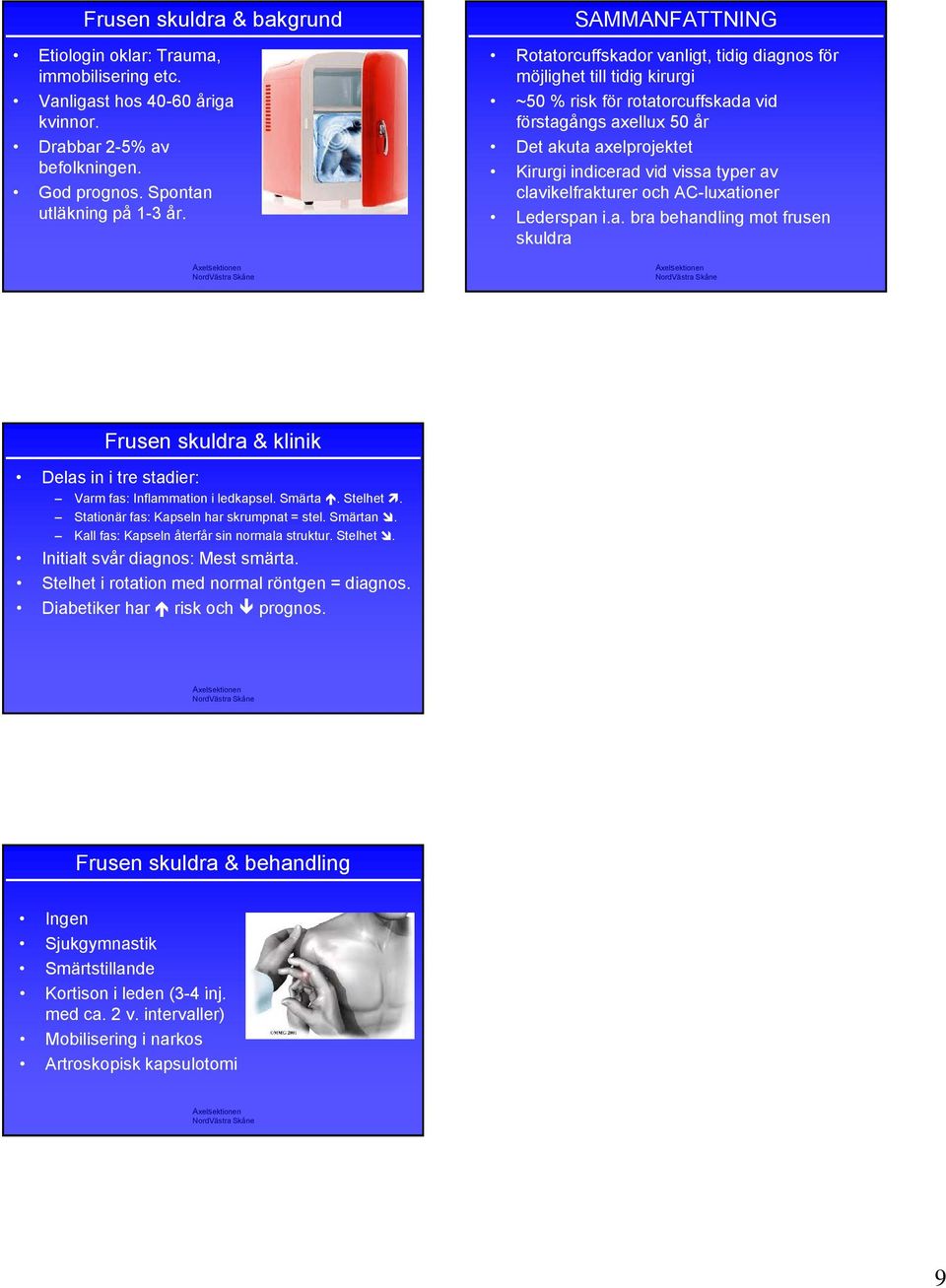 vissa typer av clavikelfrakturer och AC-luxationer Lederspan i.a. bra behandling mot frusen skuldra Frusen skuldra & klinik Delas in i tre stadier: Varm fas: Inflammation i ledkapsel. Smärta. Stelhet.