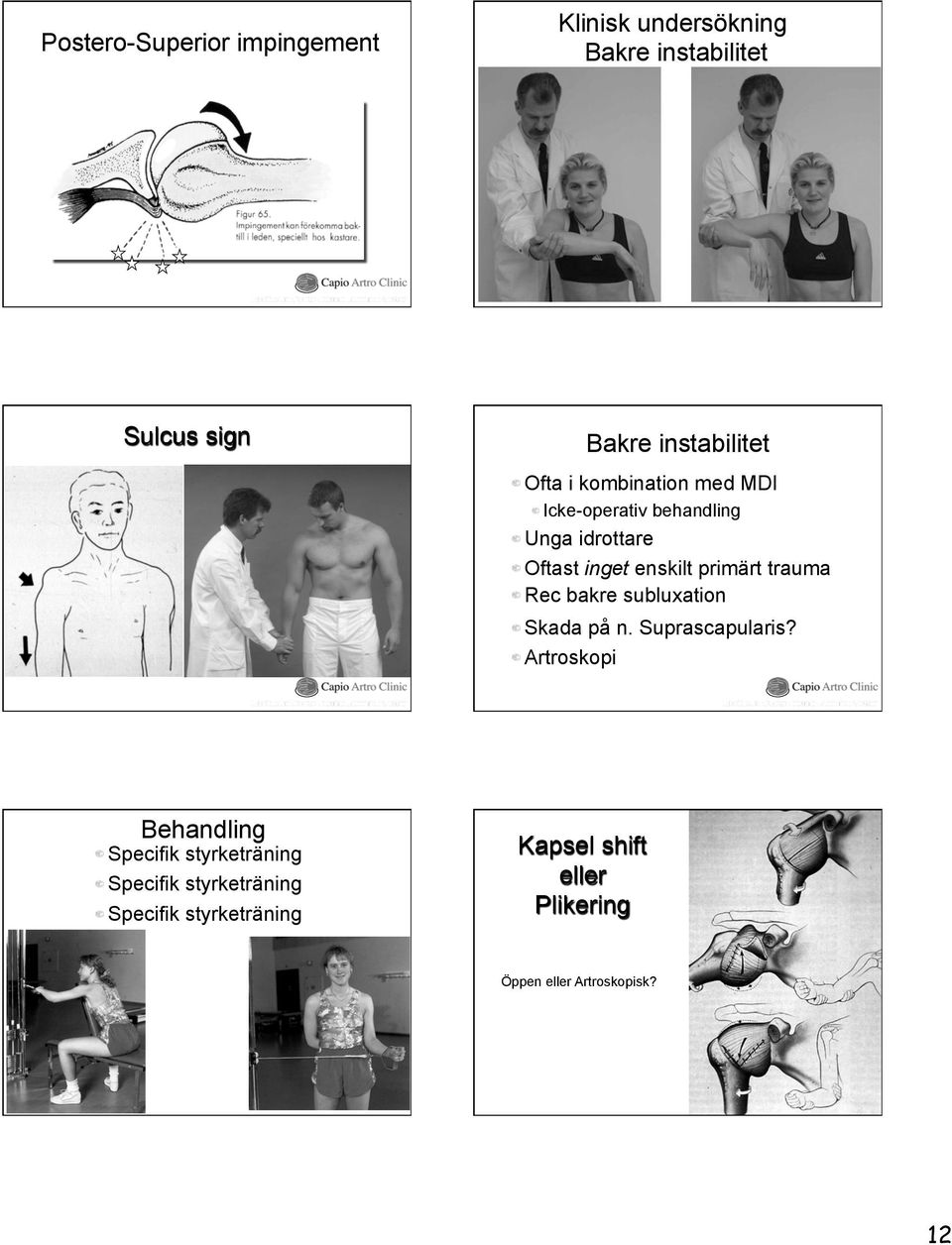 Oftast inget enskilt primärt trauma! Rec bakre subluxation! Skada på n. Suprascapularis?