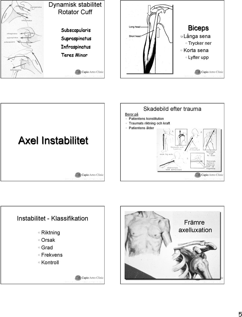 Lyfter upp Axel Instabilitet Skadebild efter trauma Beror på! Patientens konstitution!