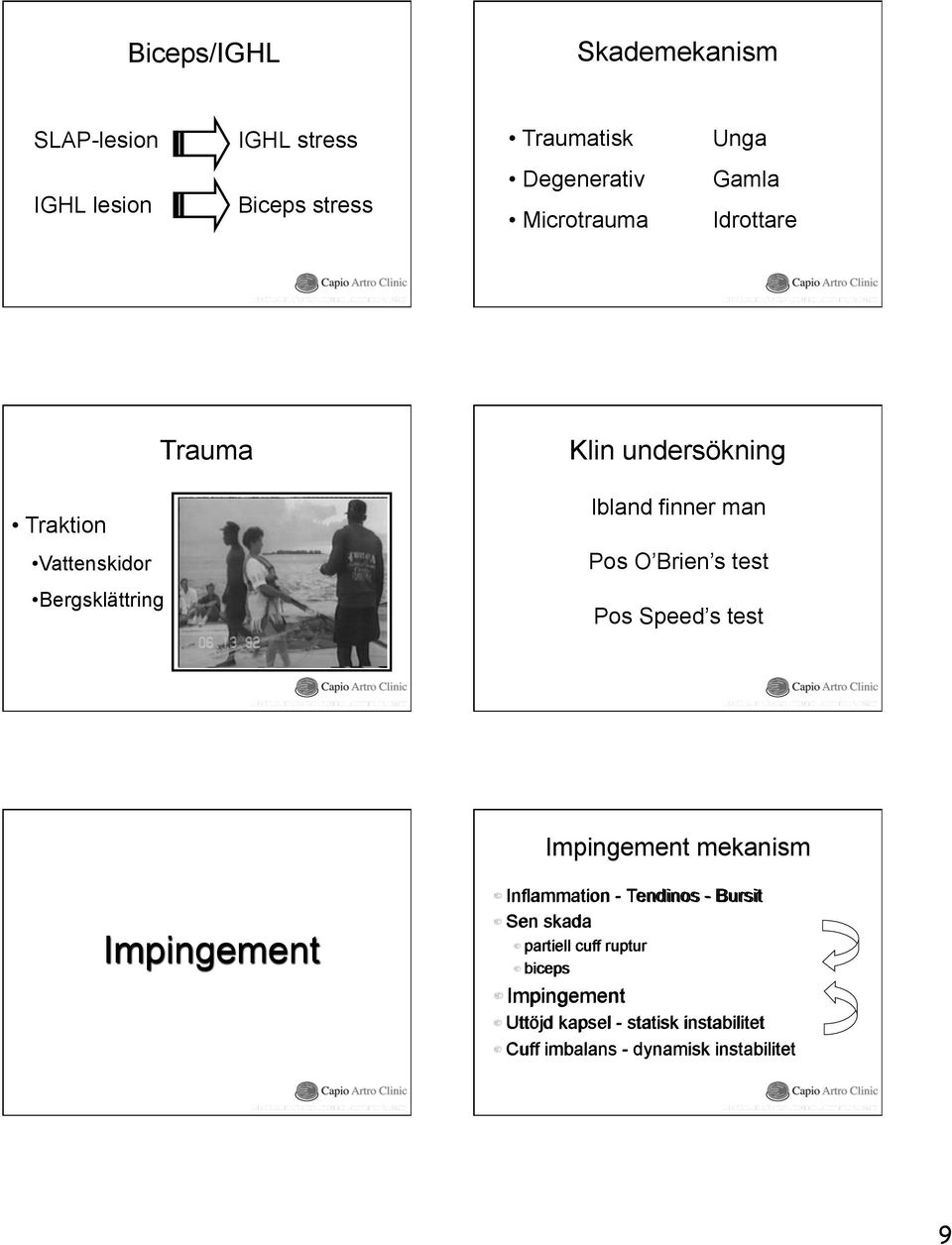 Brien s test Pos Speed s test Impingement mekanism Impingement! Inflammation - Tendinos - Bursit! Sen skada!